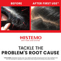 Histemo Hair Loss Prevention & Scalp Care Kit, Scalp Cleanser, Shampoo, Conditioner & Scalp Tonic, DHT Blocking Hair Restoration Treatment