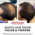 Histemo ION-TO G Hair Tonic