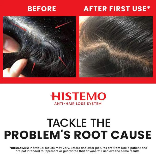 Histemo ION-TO S Scalp Cleanser
