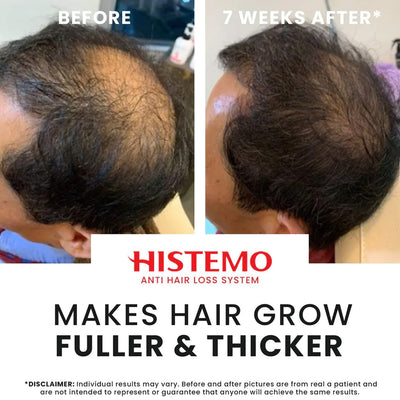 Histemo ION-TO G Hair Tonic